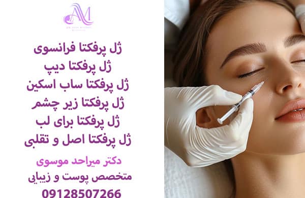 ژل پرفکتا بهتر است یا رووفیل