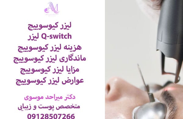 لیزر کیوسوییچ (Q-switch)