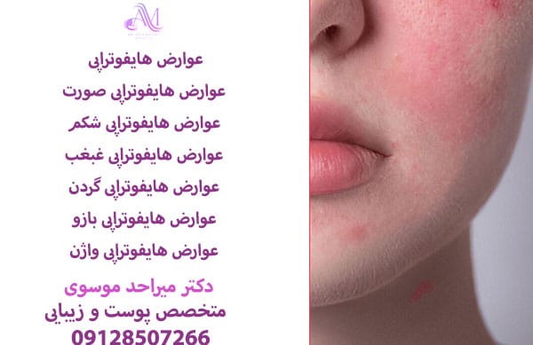 عوارض هایفوتراپی