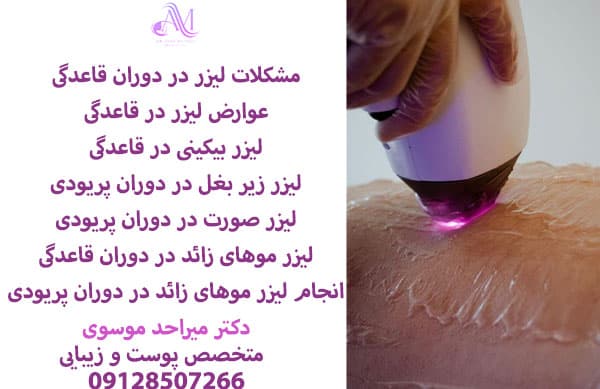 مشکلات لیزر در دوران قاعدگی