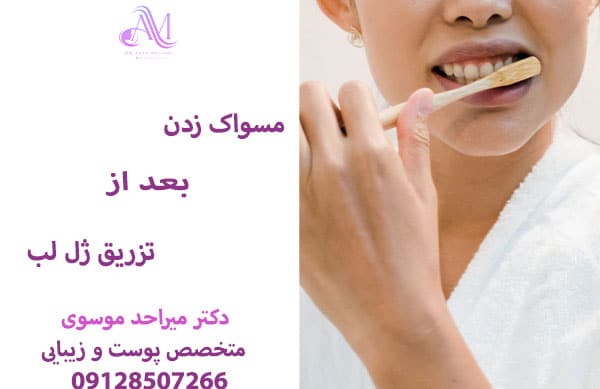 خونریزی یا درد هنگام مسواک زدن پس از تزریق ژل لب