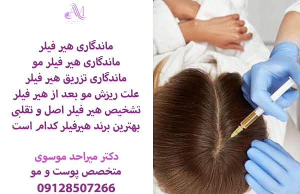 ماندگاری هیر فیلر