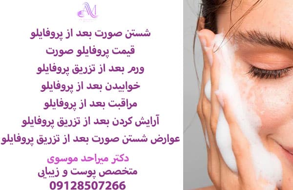 شستن صورت بعد از پروفایلو