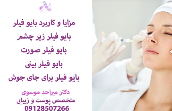 ماندگاری بایو فیلر