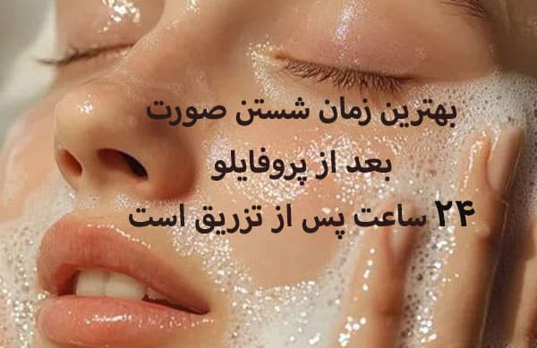 مراقبتهای پس از شستشو صورت بعد پروفایلو