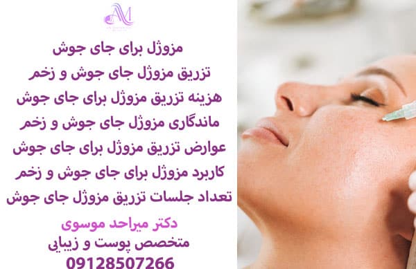 مزوژل برای جای جوش