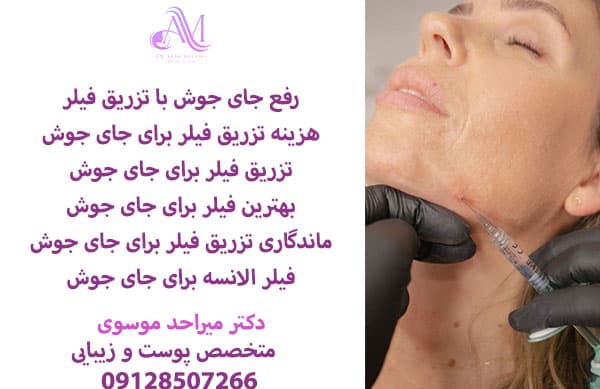 رفع جای جوش با تزریق فیلر