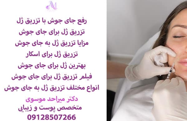 هزینه تزریق فیلر جای جوش