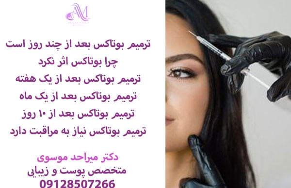 بهترین زمان ترمیم بوتاکس