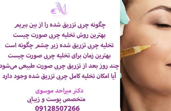 روش های تخلیه چربی بعد از تزریق