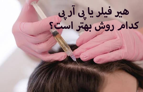 ماندگاری هیر فیلر بیشتر است یا پی آر پی