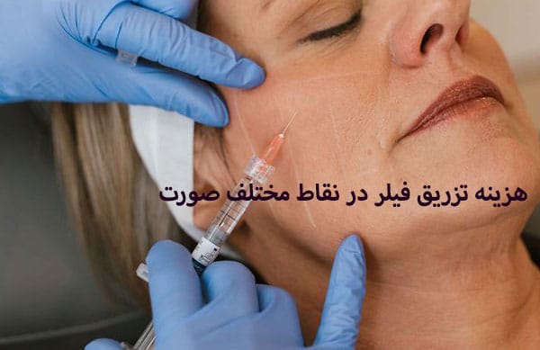 عوامل موثر بر هزینه تزریق فیلر