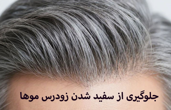 درمان موی سفید 