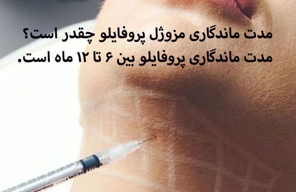 بهترین زمان تمدید مزوژل پروفایلو