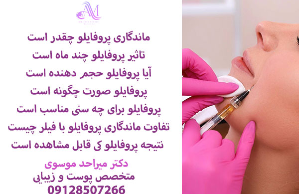 ماندگاری پروفایلو چقدر است