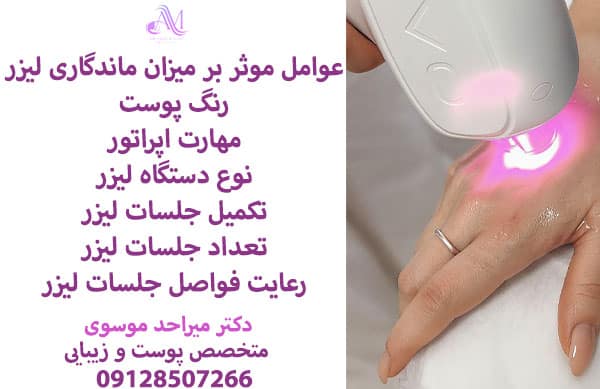 روش‌های افزایش ماندگاری لیزر موهای زائد