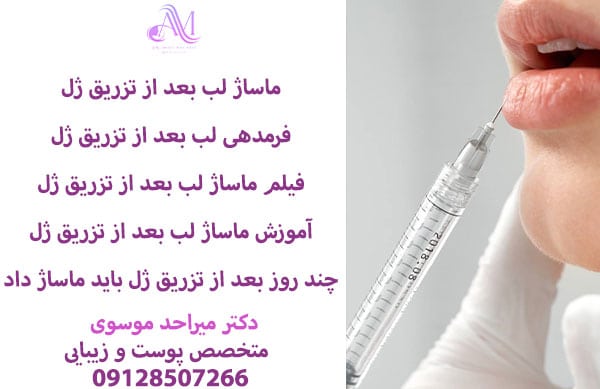 ماساژ لب بعد از تزریق ژل