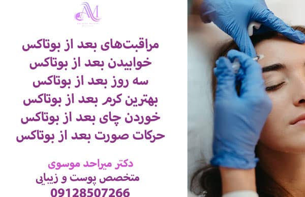 مراقبتهای بعد از بوتاکس