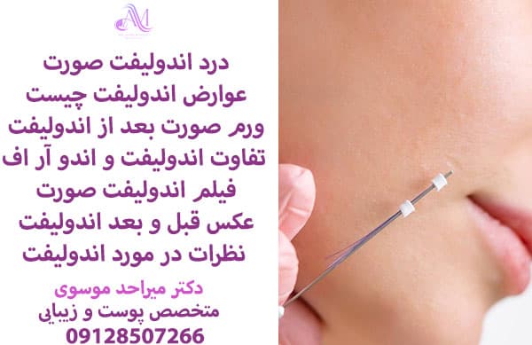 شدت درد اندولیفت بعد از انجام آن