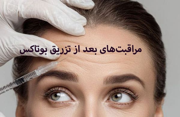 بهترین کرم بعد از بوتاکس