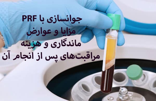 تفاوت پی آر پی و پی آر اف