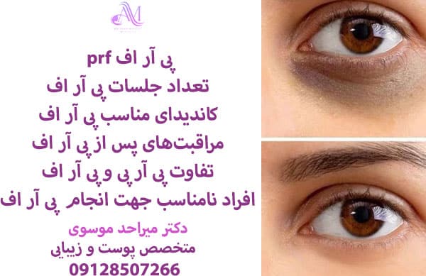 ماندگاری پی آر اف