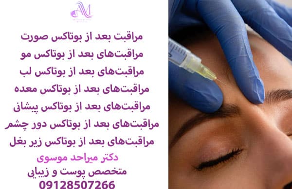 آرایش بعد از بوتاکس صورت