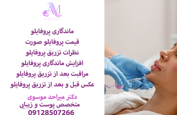 ماندگاری پروفایلو در نواحی مختلف صورت یا گردن