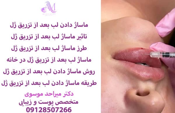 نحوه ماساژ لب بعد از تزریق ژل