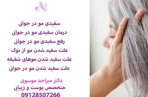 سفیدی مو در جوانی 