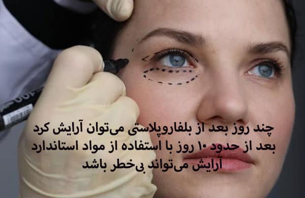 جایگزین های آرایش چشم بعد از بلفاروپلاستی