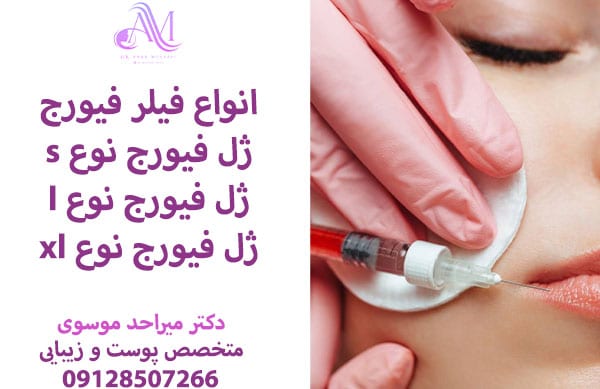 ماندگاری فیلر فیورج