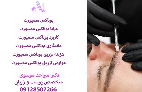 بوتاکس مصپورت