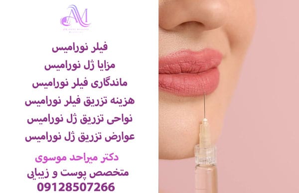 ماندگاری فیلر نورامیس