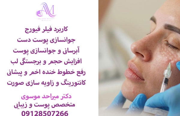 هزینه تزریق ژل فیورج