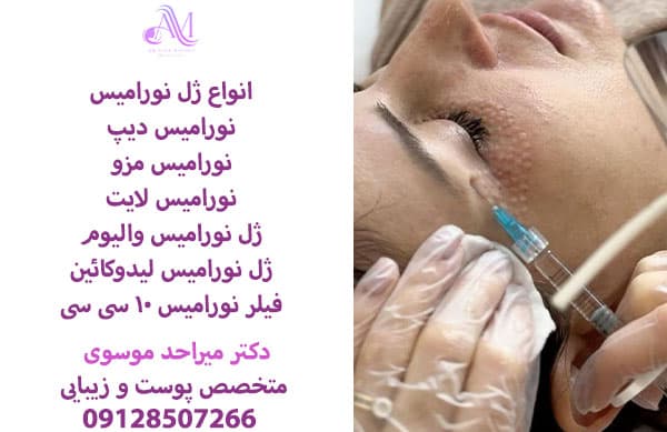 فیلر نورامیس