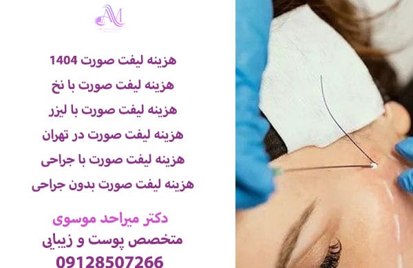 هزینه لیفت صورت در سال 1404