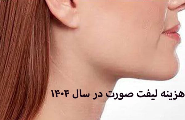 عوامل موثر بر قیمت لیفت صورت