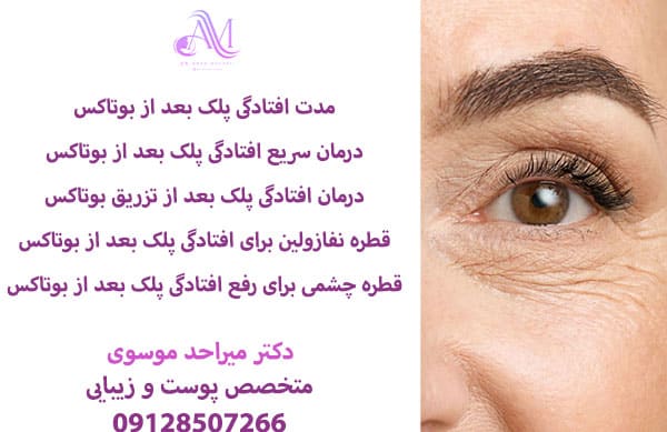 دلایل افتادگی پلک بعد از تزریق بوتاکس