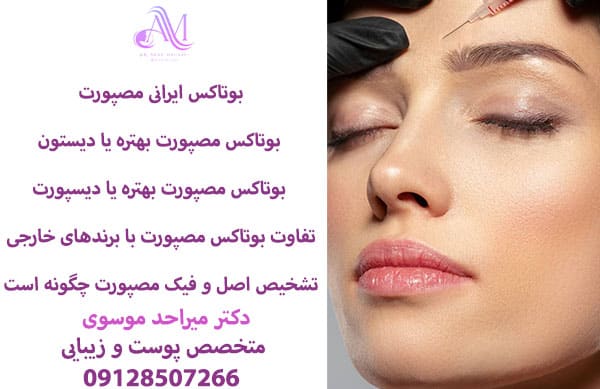 ماندگاری بوتاکس مصپورت