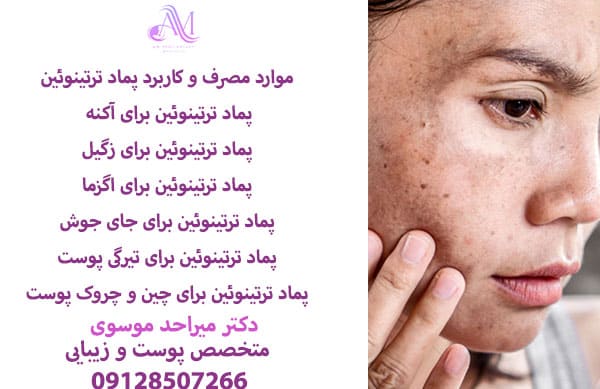 تفاوت ترتینوئین و رتینول