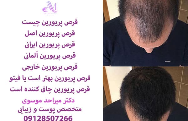 دوز مصرفی قرص پریورین