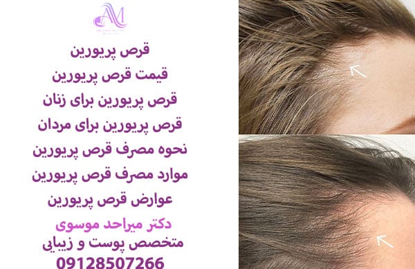 قرص پریورین