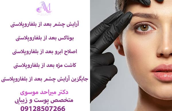 آرایش چشم بعد از بلفاروپلاستی