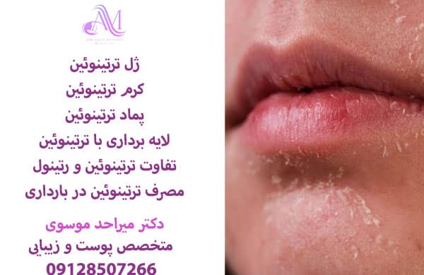 لایه برداری با ترتینوئین