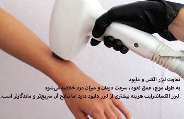 شباهت دستگاه لیزر دایود و الکساندرایت