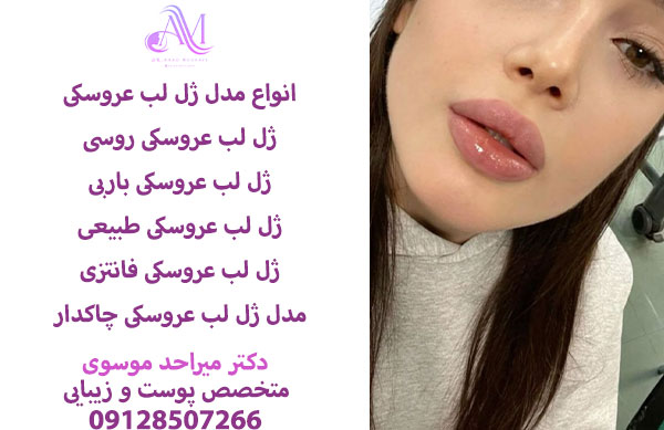 ماندگاری ژل لب عروسکی