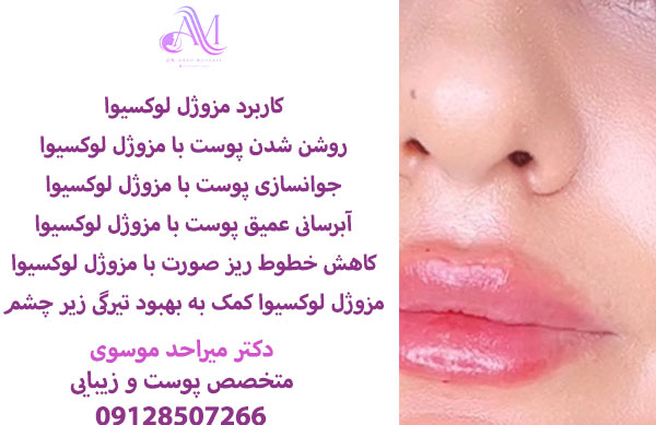 ماندگاری نتایج مزوژل لوکسیوا