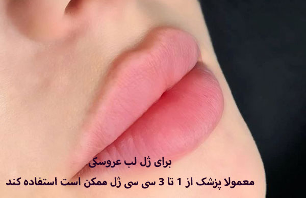 بهترین برندهای ژل برای تزریق لب عروسکی