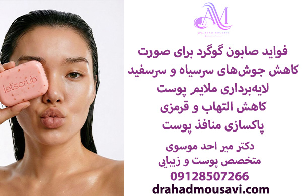 مزایای صابون گوگرد